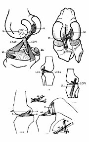 Pratique sportive et blessures du genou