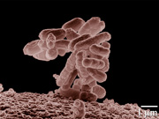 E Coli : quelles pr�cautions ?