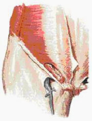Les pubalgies du footballeur