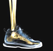 supinateur, pronateur, universel : comment acheter chaussure � votre pied ?