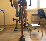 syndrome de la bandelette ilio-tibiale, avant correction