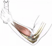 Tennis elbow Tennis elbow