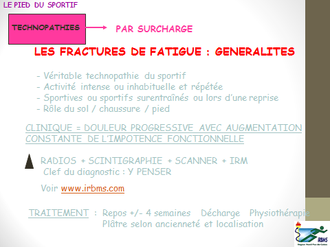 Fracture de fatigue