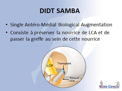 letartre-2