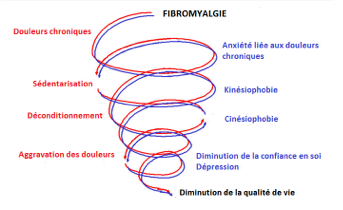 Fibromyalgie2