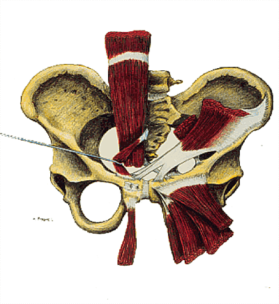 Pubalgie et rééducation après une chirurgie Pubalgie et rééducation après une chirurgie