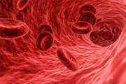 Thrombose veineuse