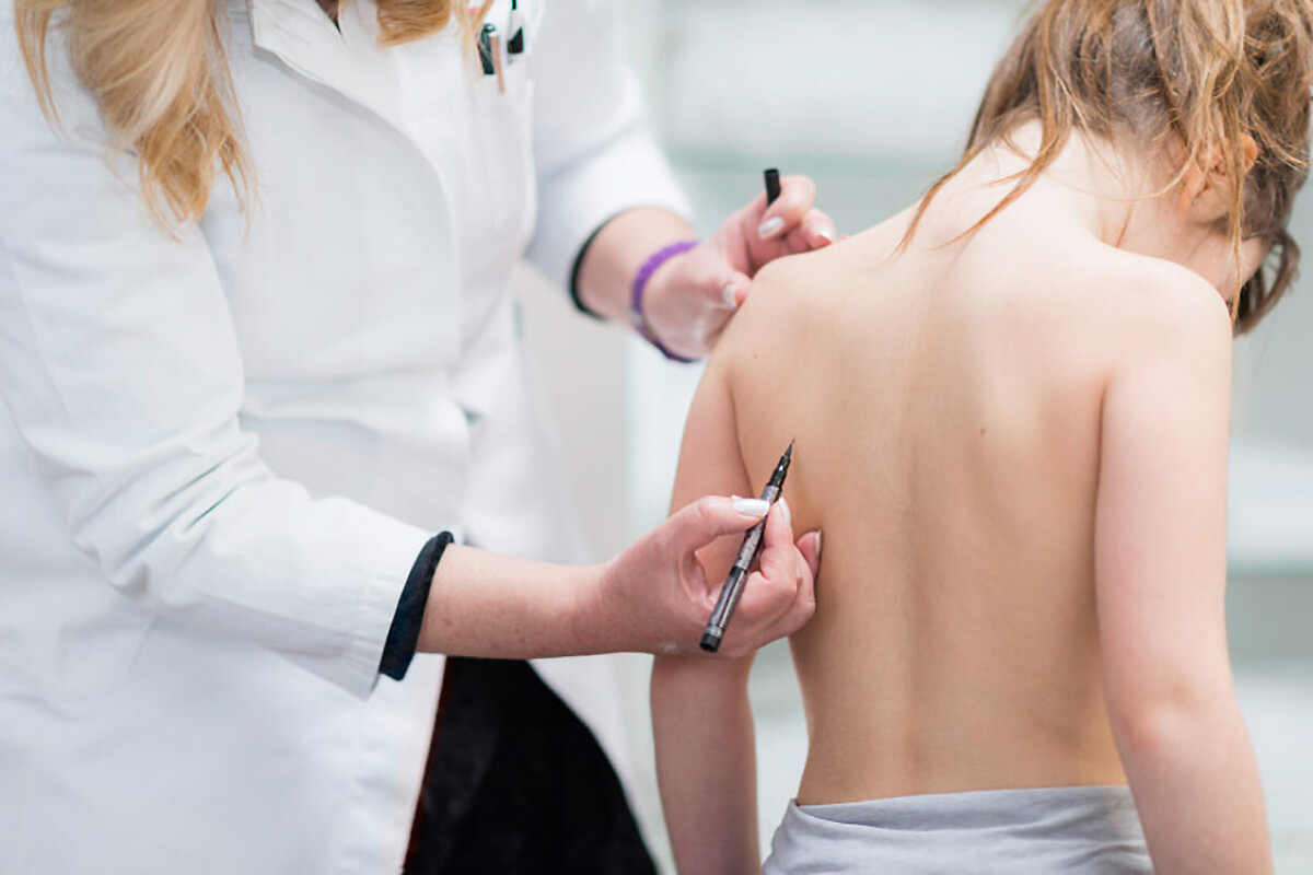 Scoliose Depistage Examen Clinique Et Diagnostic Radiologique Scoliose Depistage Examen Clinique Et Diagnostic Radiologique