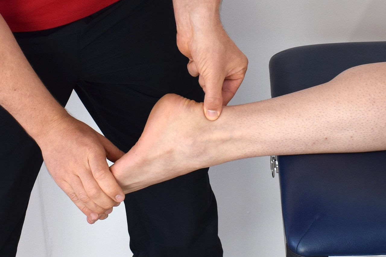 Rupture du tendon d'Achille : symptômes, temps de récupération | IRBMS