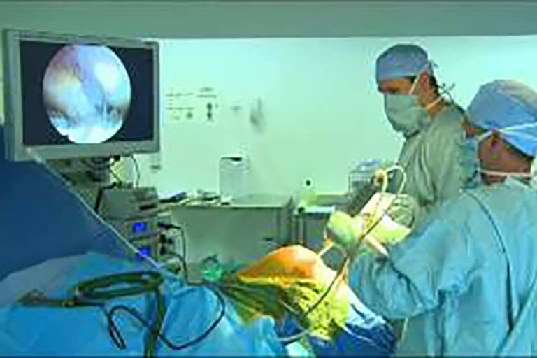 Arthroscopie du genou en ambulatoire, LCA