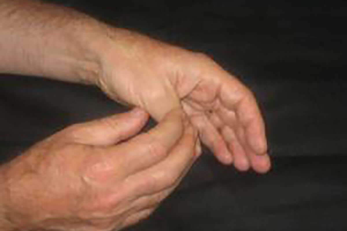 Tendinite au poignet  Tendinite du poignet chez la jeune maman -  Spécialiste de la capsulite et de la tendinite