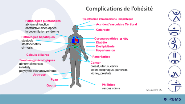 Complications de l'obésité