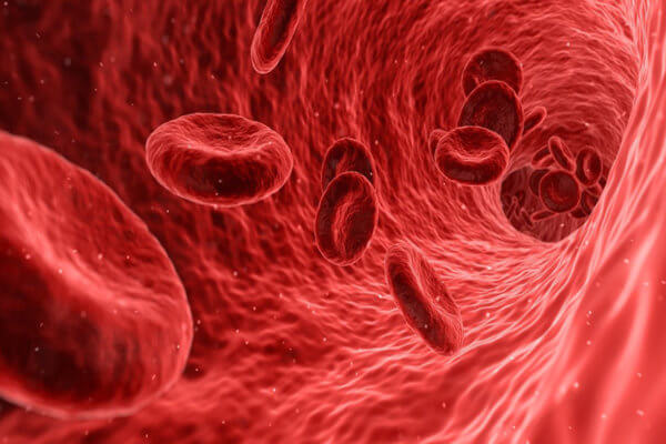 Thrombose veineuse (phlébite)