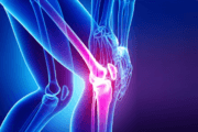 Prévention de la rupture du ligament croisé du genou
