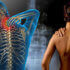 Fibromyalgie et APA